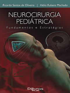 Cap Neurocirurgia Pediatrica 2